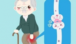 【人老腿先老，腿老在关节】关心爸妈的关节炎，专家解答、儿女必读