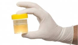 健康体检，为什么要做尿常规？