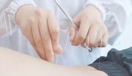 【招募令】“居”针还可以治疗高血压？要不来试试