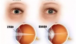 眼尖的“铁粉们”【“俊”医“明”眼】男主角——眼科主任罗俊闪亮登场