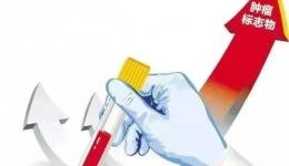 【吾愿讲你听第六期】肿瘤标志物升高就一定得了癌症吗？