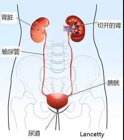 不痛、不痒”血尿——泌尿外科不容忽视的“大”问题-医院新闻-新闻中心-四川 