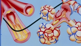 测血压，您做对了吗？