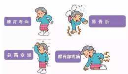 骨质疏松不可怕，中医中药完美搭