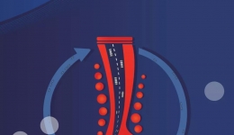 “沉默的杀手”——静脉血栓栓塞症