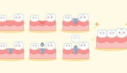 【新技术】一分钟带你了解种植牙