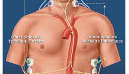 【创新发展】好消息！我院心血管内科又推出新技术——无创心功能检测