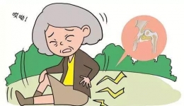 【老年特色诊疗技术】24小时内成功为86岁高龄老人实施椎管内麻醉人工股骨头置换术