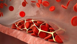 【老年特色门诊】四川省第五人民医院（四川省老年医院）新开“老年血栓门诊”