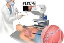 【诊疗技术】精准锁定“大脑风暴”：神经内科视频脑电图（VEEG）成功完成首例患者检测