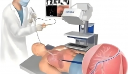 【診療技術】精準鎖定“大腦風暴”：神經(jīng)內科視頻腦電圖（VEEG）成功完成首例患者檢測