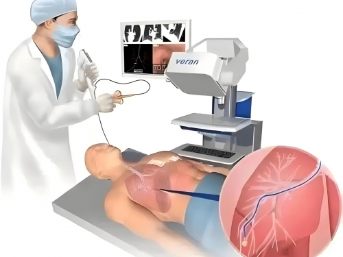 【诊疗技术】精准锁定“大脑风暴”：神经内科视频脑电图（VEEG）成功完成首例患者检测