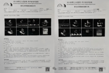 【老年诊疗模式】跨院区标准化全程管理—为心脏围手术期患者打通生命健康路！