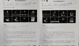 【老年诊疗模式】跨院区标准化全程管理—为心脏围手术期患者打通生命健康路！