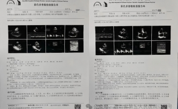 【老年诊疗模式】跨院区标准化全程管理—为心脏围手术期患者打通生命健康路！